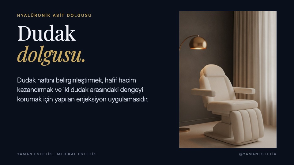 Lacivert altın palet, Playfair
